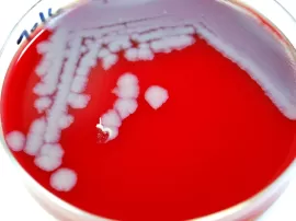 Las mejores opciones de estuches de colonias para niñas según su edad y dónde encontrarlas