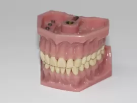 Comparación de pegamentos para dentaduras postizas en supermercados populares: opciones, recomendaciones y opiniones.
