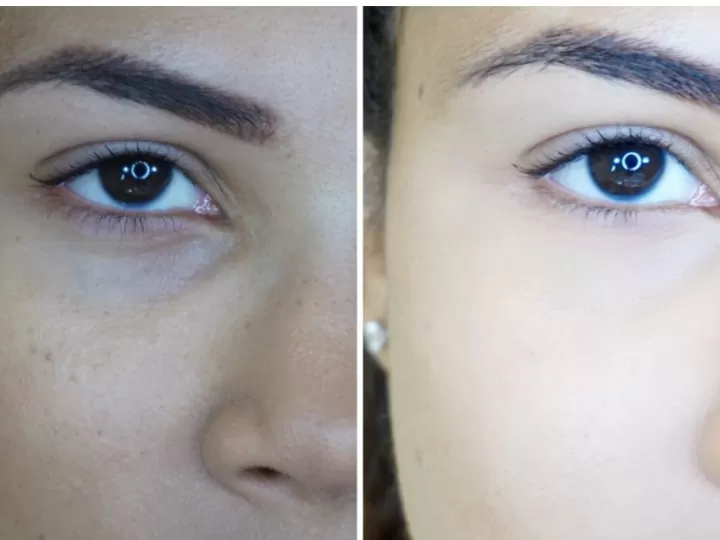 Como Tapar Las Ojeras En 5 Simples Pasos