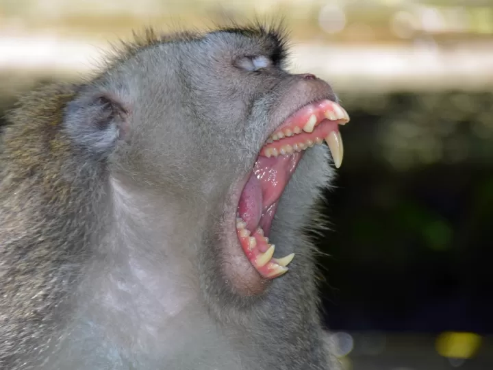 dientes grises causas