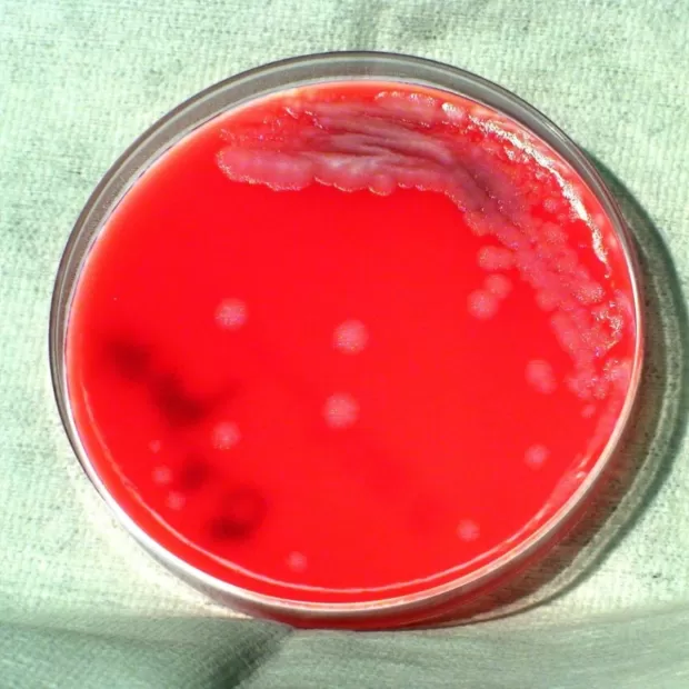 ethylhexyl salicylate