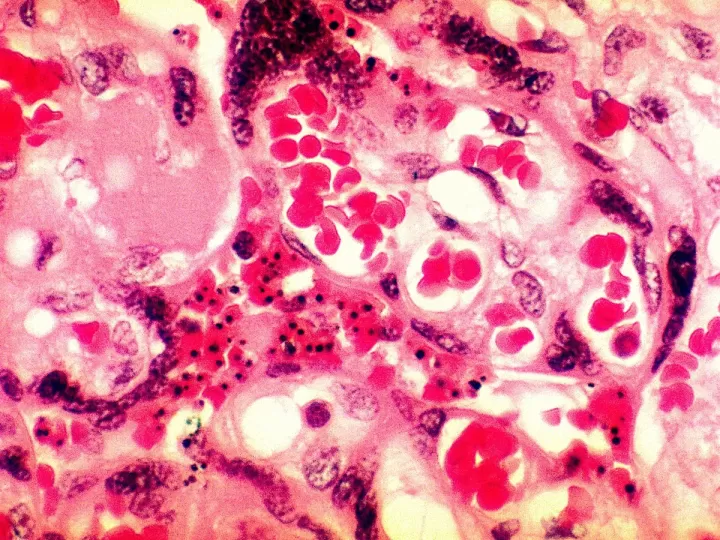 mejores ampollas de placenta para el pelo